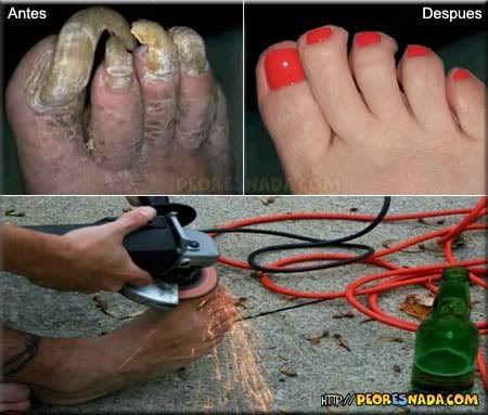 imagenes imagenes